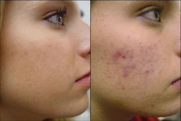 ניקוי פנים בסלון: מרכיב חשוב של טיפוח העור