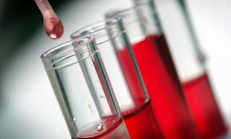 תאי דם לבנים גבוהים בדם: מהם הגורמים ומהם הטיפול?